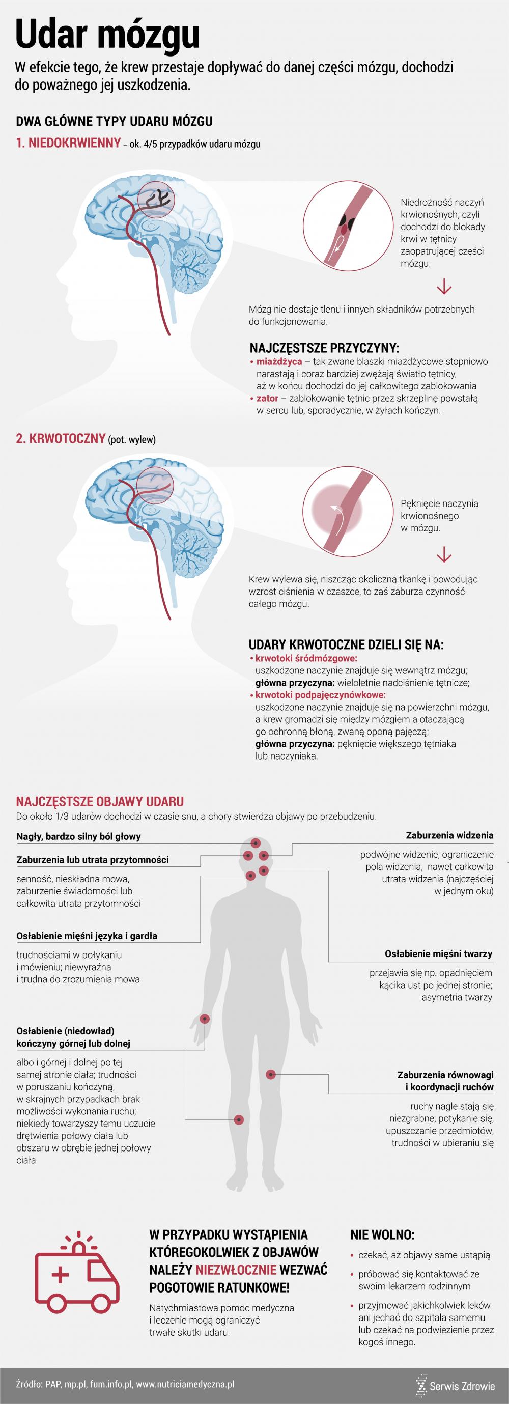 Infografika PAP/Serwis Zdrowie/Udar mózgu_objawy