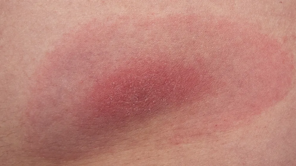 Adobe Stock/dennisjacobsen