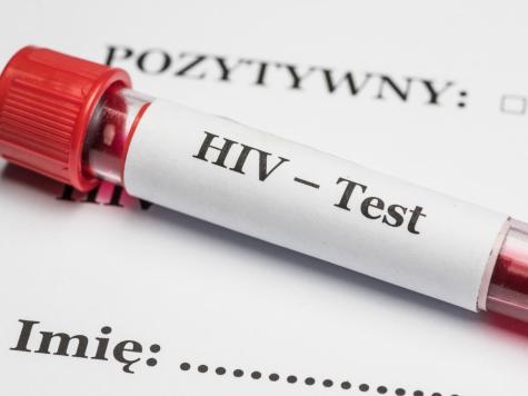 Test HIV/Fot.PAP