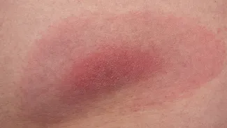 Adobe Stock/dennisjacobsen