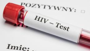 Test HIV/Fot.PAP